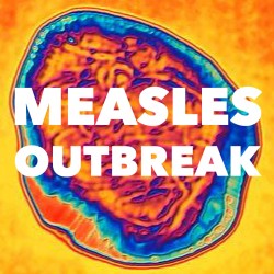 Dr. Carsrud’s Take on Measles Outbreak