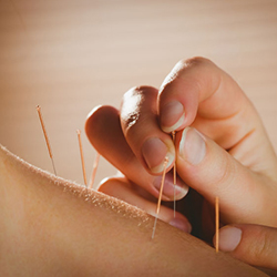 Acupuncture For Fertility